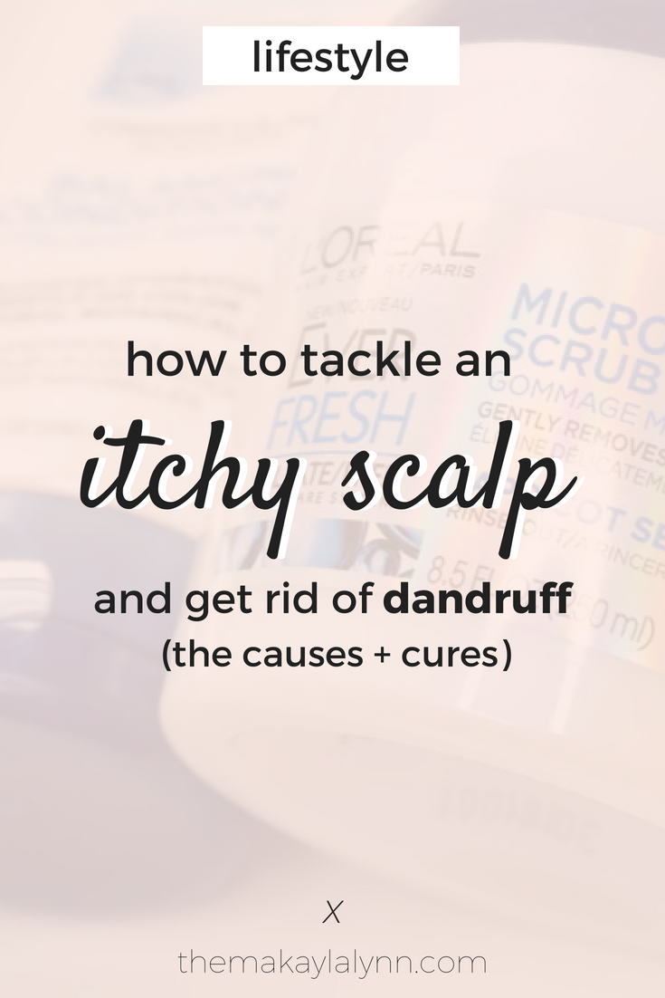 How to Tackle an Itchy Scalp and Get Rid of Dandruff